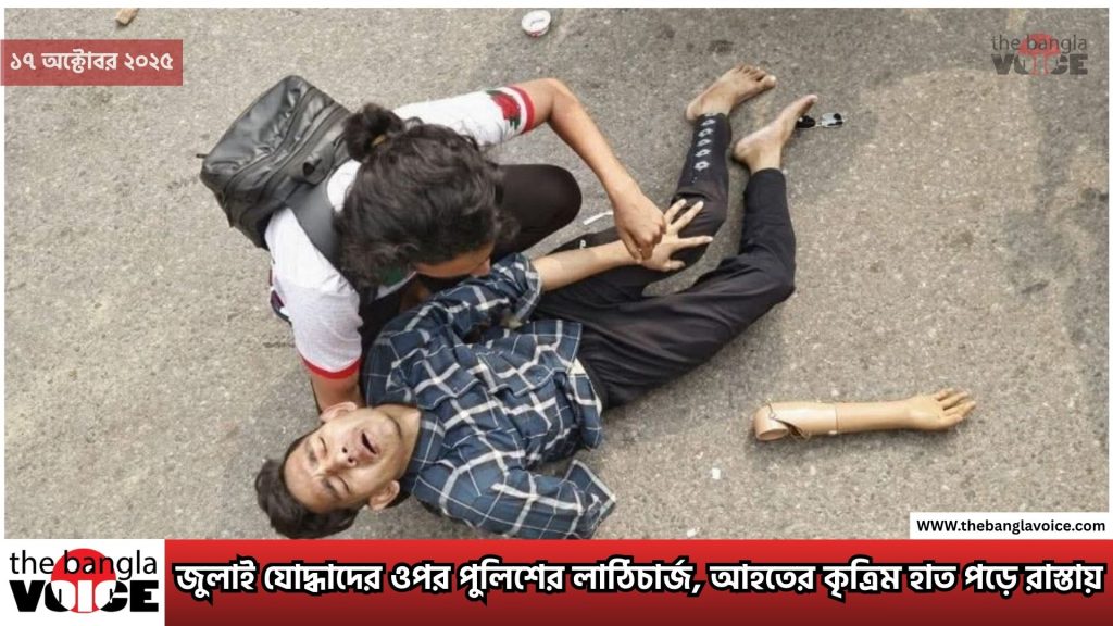রাজধানীর সংসদ ভবনে উত্তেজনা: জুলাই যোদ্ধাদের ওপর পুলিশের লাঠিচার্জ, আহতের কৃত্রিম হাত পড়ে রাস্তায়