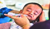 দেশে হামে ও হামের উপসর্গে মৃত্যু ৮০০ ছুঁইছুঁই, চার মাসে প্রাণ গেল ৭৯৭ শিশুর